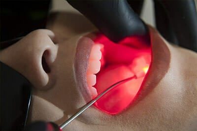 Laserterapia odontológica no Rio de Janeiro